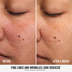 SKIN RESCUE Pure Smooth Serum with 5% Niacinamide and Chebula